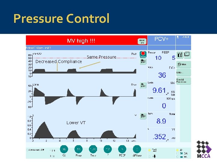 Pressure Control Decreased Compliance Lower VT Same Pressure 