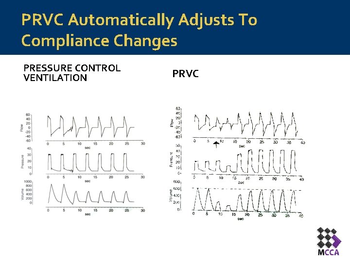 PRVC Automatically Adjusts To Compliance Changes PRESSURE CONTROL VENTILATION PRVC 