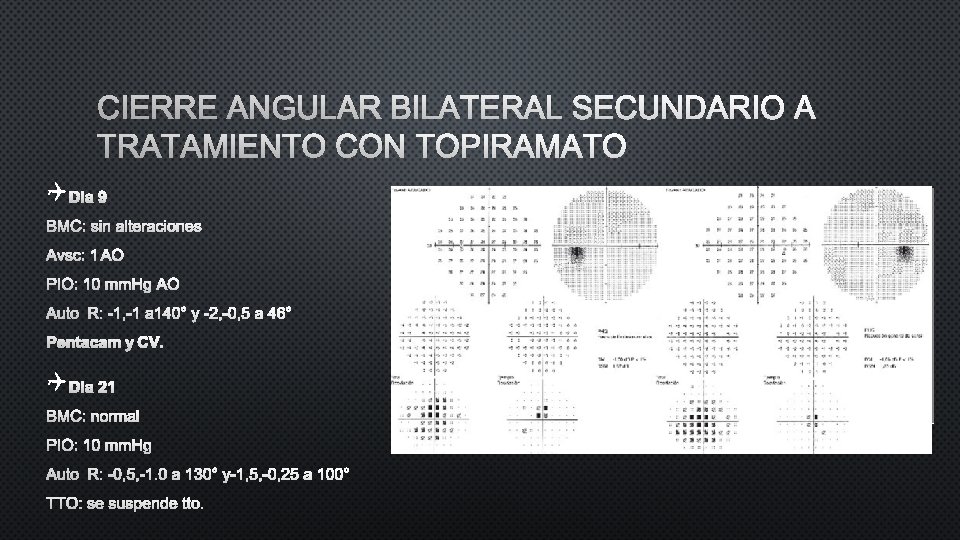CIERRE ANGULAR BILATERAL SECUNDARIO A TRATAMIENTO CON TOPIRAMATO Q DIA 9 BMC: SIN ALTERACIONES CIERRE ANGULAR BILATERAL SECUNDARIO A TRATAMIENTO CON TOPIRAMATO Q DIA 9 BMC: SIN ALTERACIONES