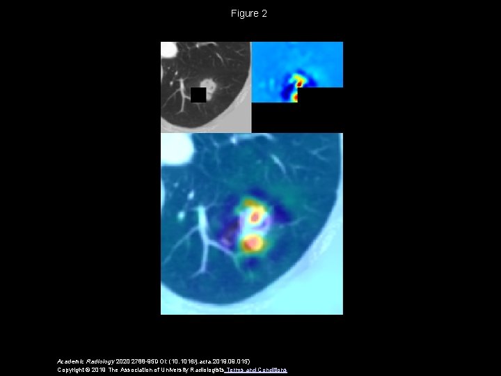 Figure 2 Academic Radiology 2020 2788 -95 DOI: (10. 1016/j. acra. 2019. 015) Copyright