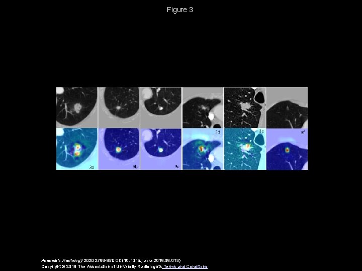 Figure 3 Academic Radiology 2020 2788 -95 DOI: (10. 1016/j. acra. 2019. 015) Copyright