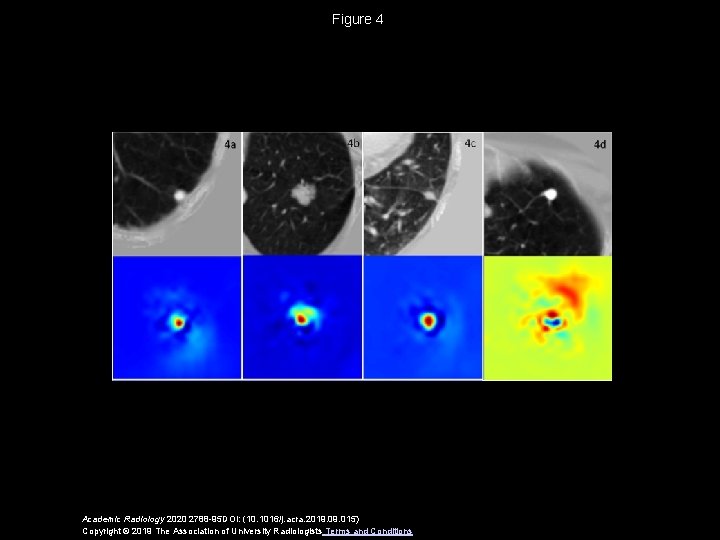 Figure 4 Academic Radiology 2020 2788 -95 DOI: (10. 1016/j. acra. 2019. 015) Copyright