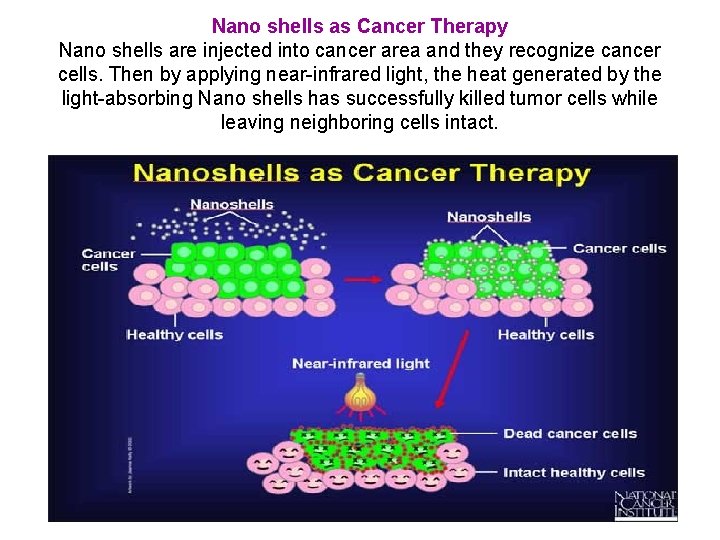 Nano shells as Cancer Therapy Nano shells are injected into cancer area and they