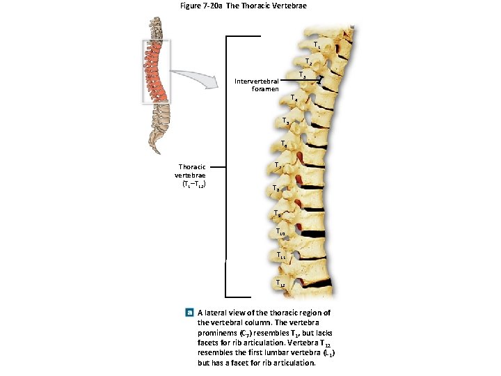 Figure 7 -20 a The Thoracic Vertebrae T 1 T 2 T 3 Intervertebral