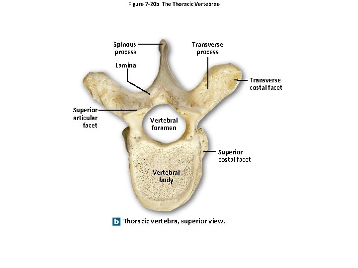 Figure 7 -20 b The Thoracic Vertebrae Spinous process Transverse process Lamina Transverse costal