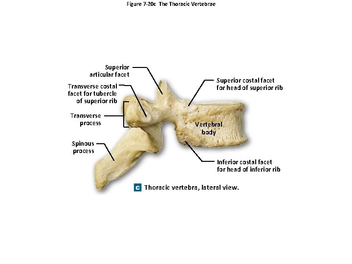 Figure 7 -20 c The Thoracic Vertebrae Superior articular facet Transverse costal facet for