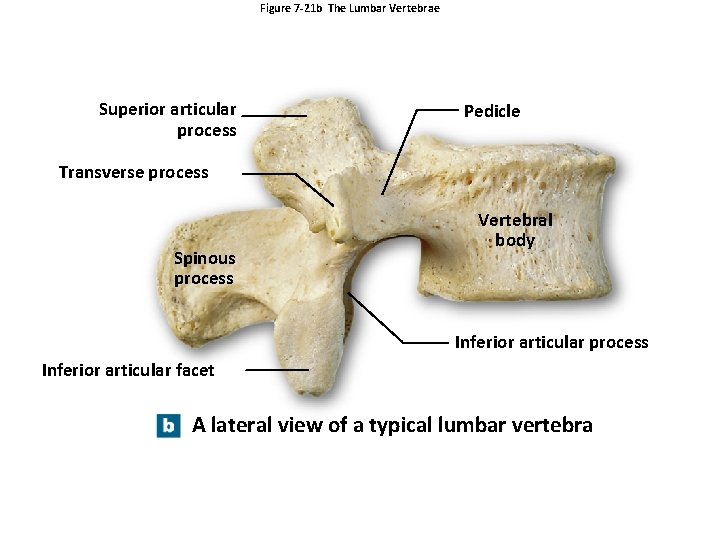 Figure 7 -21 b The Lumbar Vertebrae Superior articular process Pedicle Transverse process Spinous