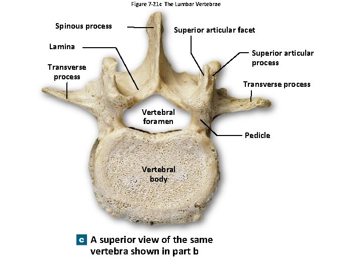 Figure 7 -21 c The Lumbar Vertebrae Spinous process Superior articular facet Lamina Superior