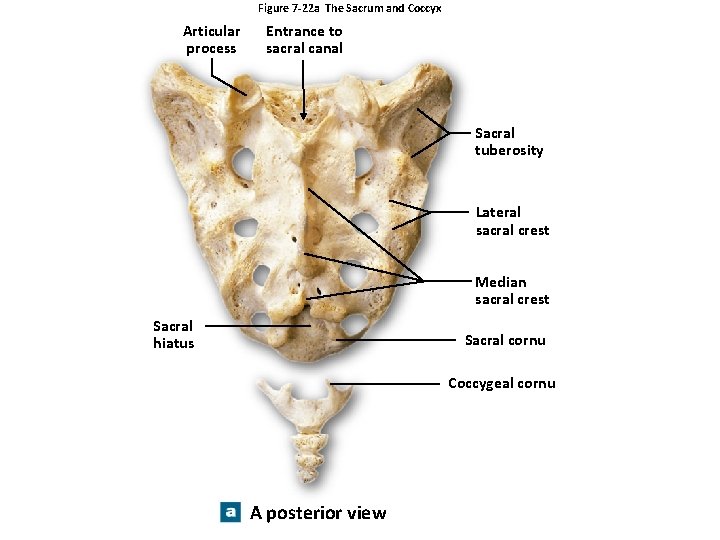 Figure 7 -22 a The Sacrum and Coccyx Articular process Entrance to sacral canal