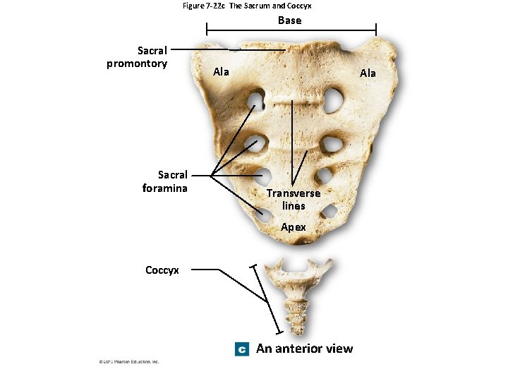 Figure 7 -22 c The Sacrum and Coccyx Base Sacral promontory Sacral foramina Ala