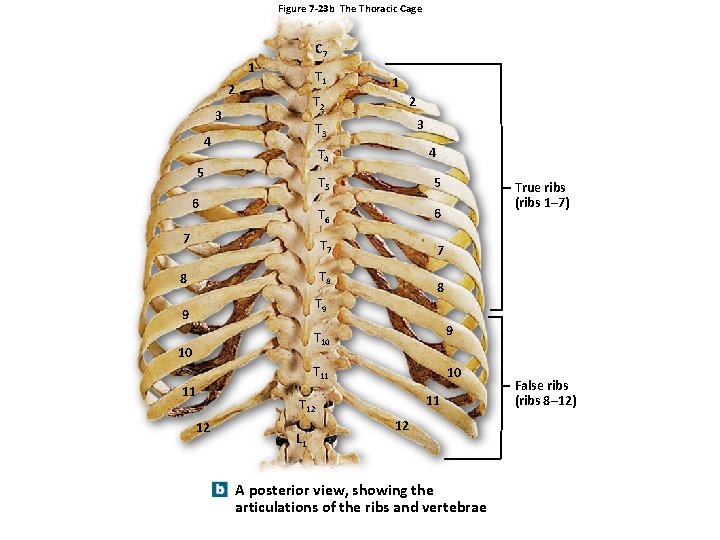 Figure 7 -23 b The Thoracic Cage C 7 1 T 1 2 T