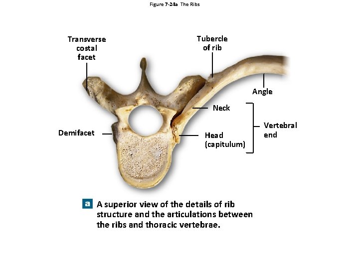 Figure 7 -24 a The Ribs Transverse costal facet Tubercle of rib Angle Neck