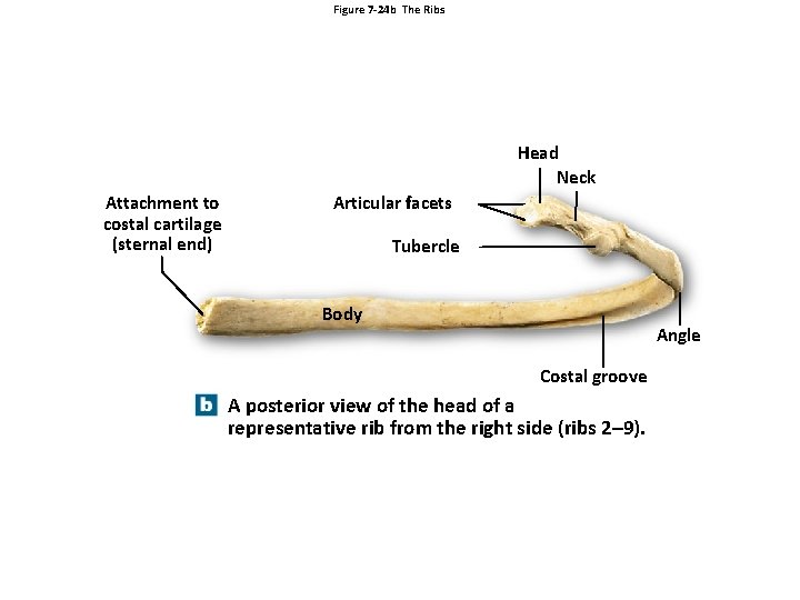 Figure 7 -24 b The Ribs Head Neck Attachment to costal cartilage (sternal end)