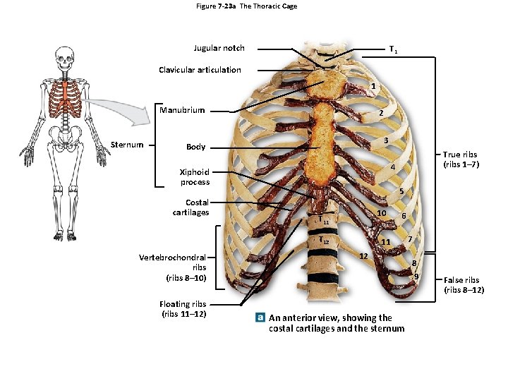 Figure 7 -23 a The Thoracic Cage Jugular notch T 1 Clavicular articulation 1