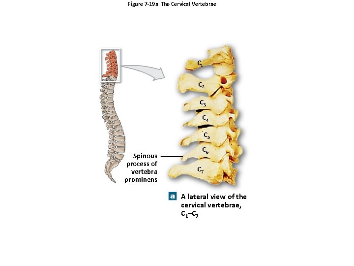 Figure 7 -19 a The Cervical Vertebrae C 1 C 2 C 3 C