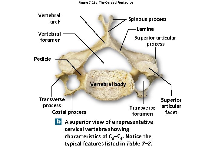 Figure 7 -19 b The Cervical Vertebrae Vertebral arch Spinous process Lamina Superior articular