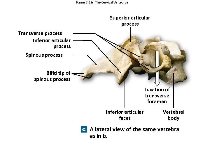 Figure 7 -19 c The Cervical Vertebrae Superior articular process Transverse process Inferior articular