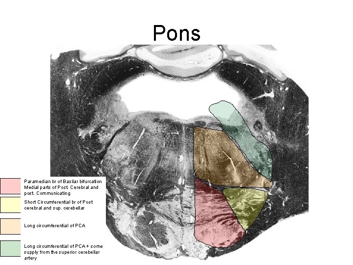 Pons Paramedian br of Basilar bifurcation Medial parts of Post. Cerebral and post. Communicating