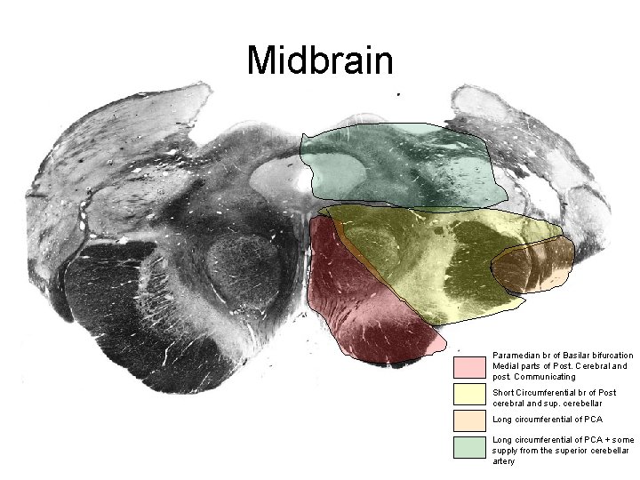 Midbrain Paramedian br of Basilar bifurcation Medial parts of Post. Cerebral and post. Communicating