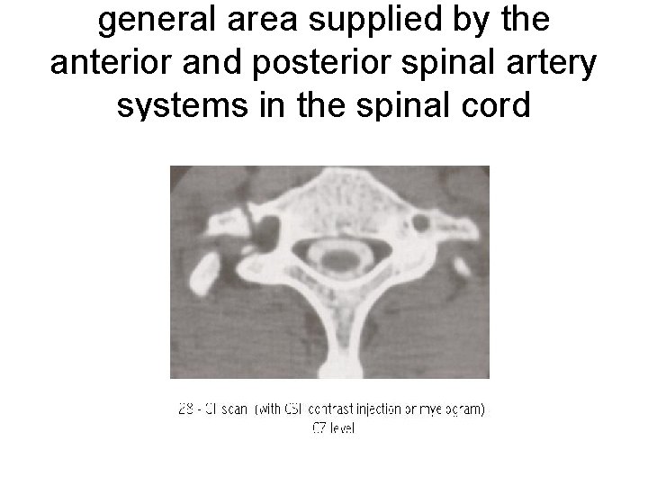 general area supplied by the anterior and posterior spinal artery systems in the spinal