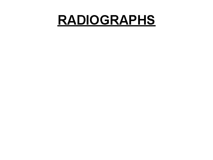 RADIOGRAPHS 