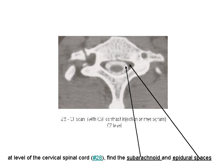 at level of the cervical spinal cord (#28), find the subarachnoid and epidural spaces