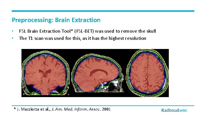 Preprocessing: Brain Extraction • • FSL Brain Extraction Tool* (FSL-BET) was used to remove