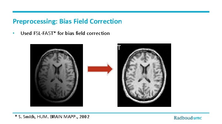 Preprocessing: Bias Field Correction • Used FSL-FAST* for bias field correction FSL FAST *