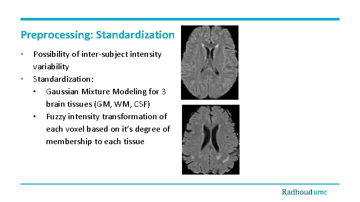 Preprocessing: Standardization • • Possibility of inter-subject intensity variability Standardization: • Gaussian Mixture Modeling