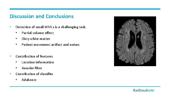 Discussion and Conclusions • • • Detection of small WMLs is a challenging task.