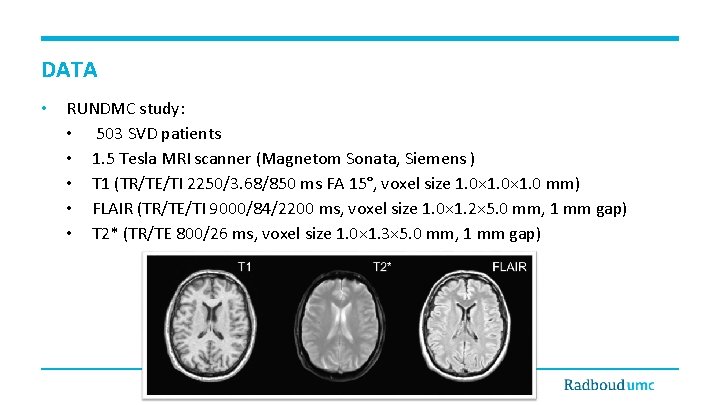 DATA • RUNDMC study: • 503 SVD patients • 1. 5 Tesla MRI scanner