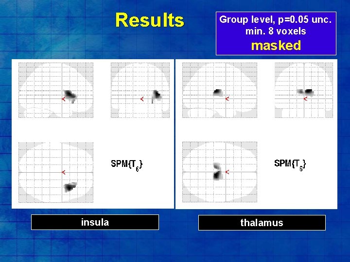 Results Group level, p=0. 05 unc. min. 8 voxels masked insula thalamus 