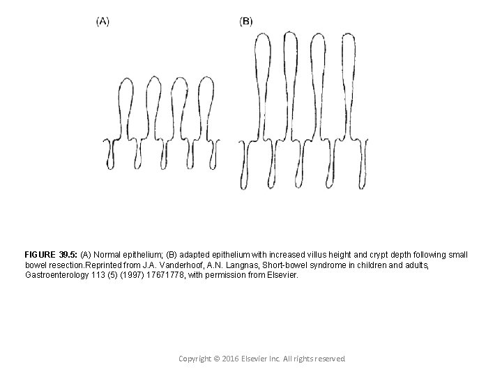 FIGURE 39. 5: (A) Normal epithelium; (B) adapted epithelium with increased villus height and