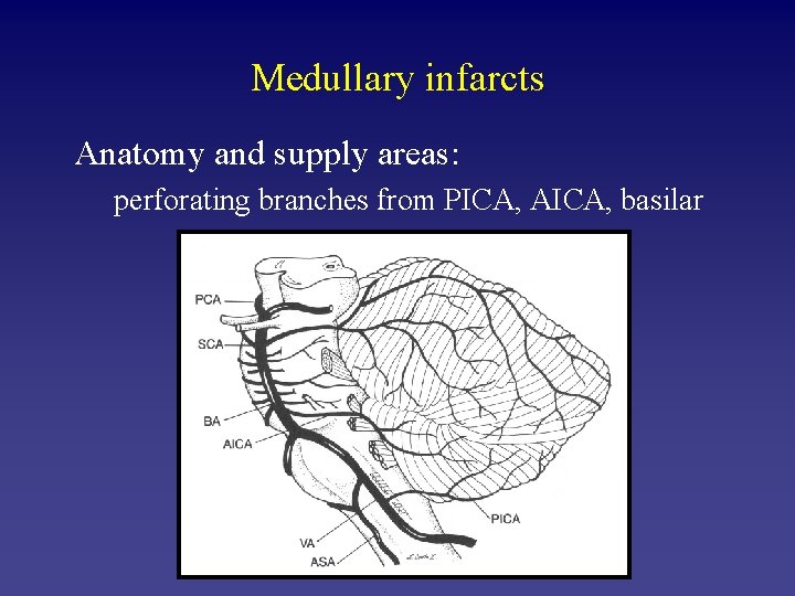 Medullary infarcts Anatomy and supply areas: perforating branches from PICA, AICA, basilar 