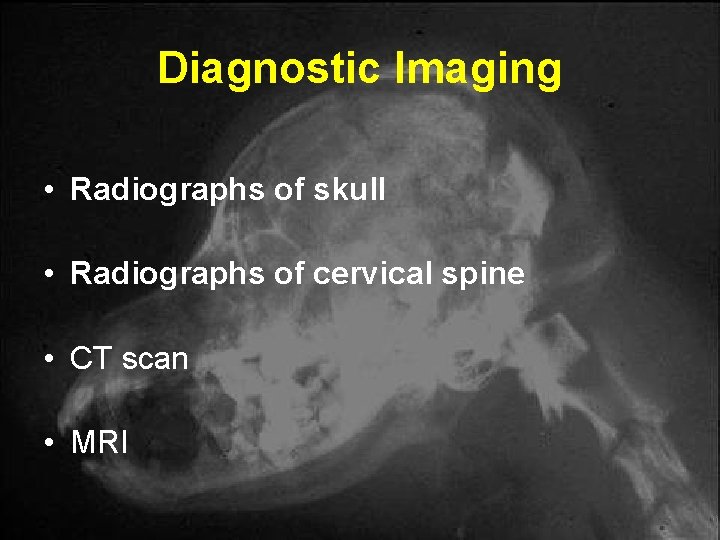 Diagnostic Imaging • Radiographs of skull • Radiographs of cervical spine • CT scan Diagnostic Imaging • Radiographs of skull • Radiographs of cervical spine • CT scan