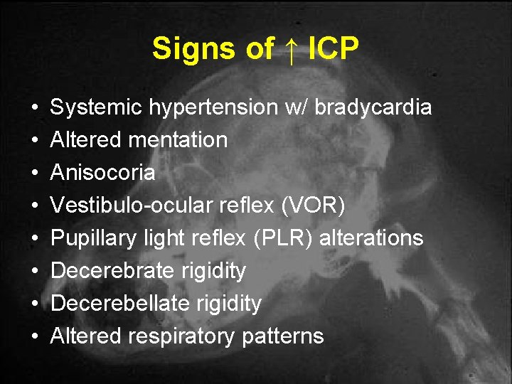 Signs of ↑ ICP • • Systemic hypertension w/ bradycardia Altered mentation Anisocoria Vestibulo-ocular Signs of ↑ ICP • • Systemic hypertension w/ bradycardia Altered mentation Anisocoria Vestibulo-ocular