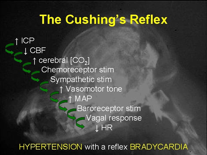 The Cushing’s Reflex ↑ ICP ↓ CBF ↑ cerebral [CO 2] Chemoreceptor stim Sympathetic