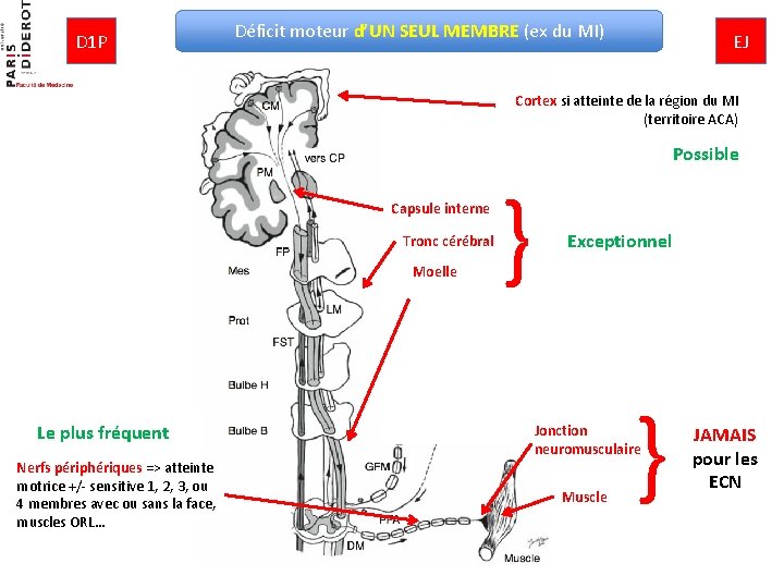 D 1 P Déficit moteur d’UN SEUL MEMBRE (ex du MI) EJ Cortex si