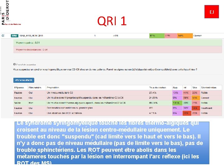 QRI 1 Le syndrome syringomye lique touche les fibres thermo-algiques qui croisent au niveau