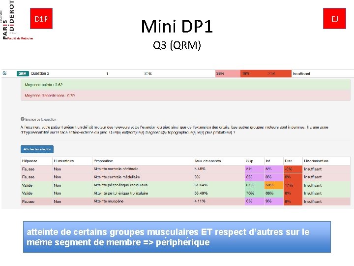 D 1 P Mini DP 1 Q 3 (QRM) atteinte de certains groupes musculaires