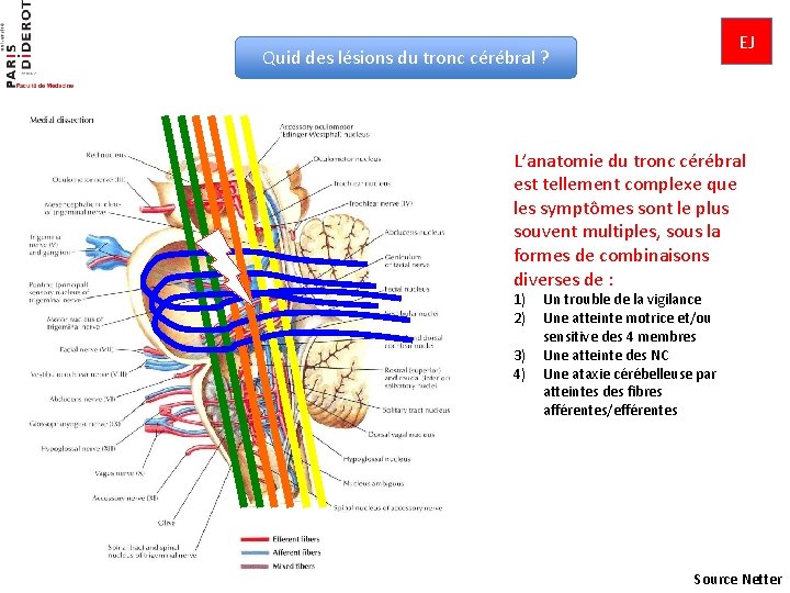 EJ Quid des lésions du tronc cérébral ? L’anatomie du tronc cérébral est tellement