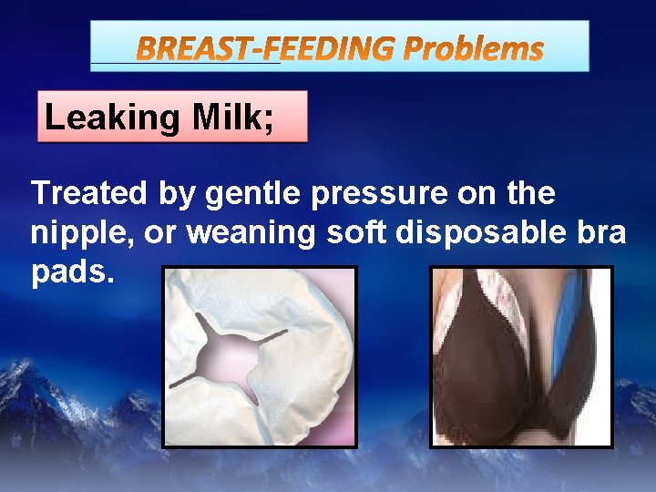 Leaking Milk; Treated by gentle pressure on the nipple, or weaning soft disposable bra