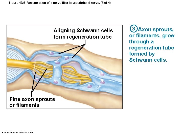 Figure 13. 5 Regeneration of a nerve fiber in a peripheral nerve. (3 of