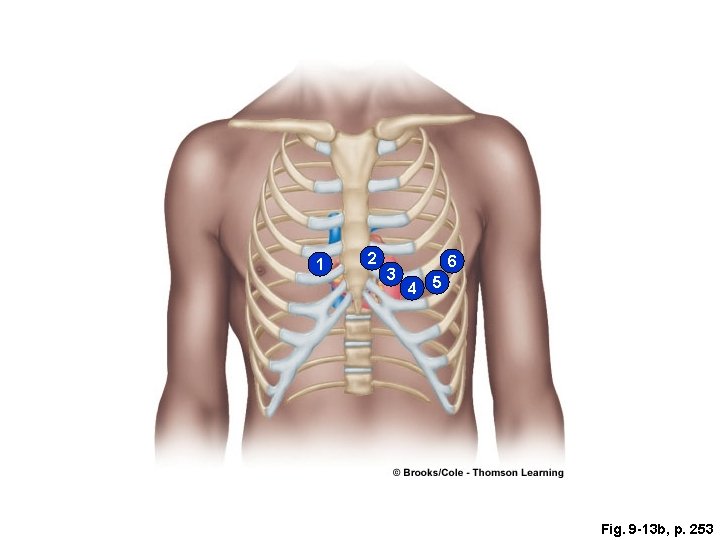 1 2 3 6 4 5 Fig. 9 -13 b, p. 253 