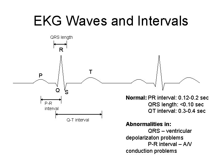 EKG Waves and Intervals QRS length R T P Q S P-R interval Q-T