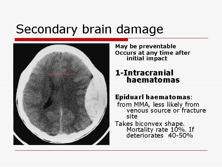 Secondary brain damage May be preventable Occurs at any time after initial impact 1