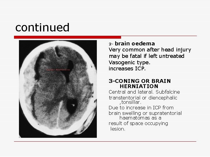 continued brain oedema Very common after head injury may be fatal if left untreated