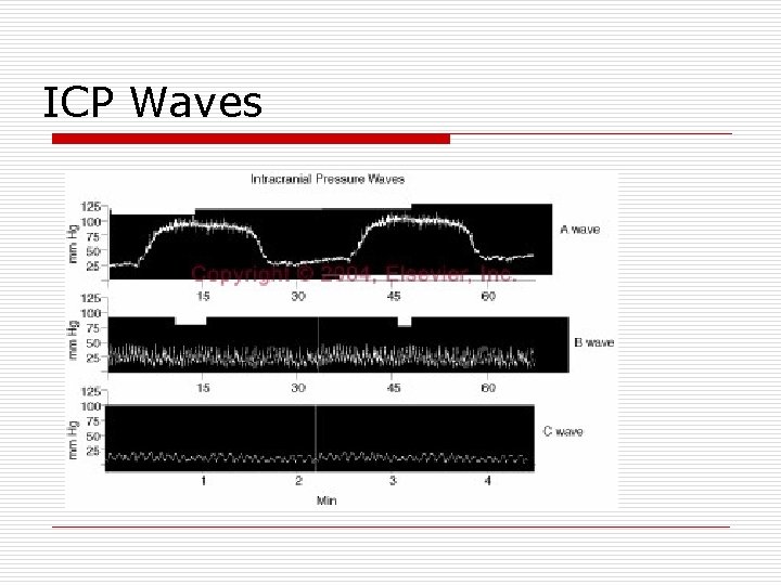 ICP Waves 