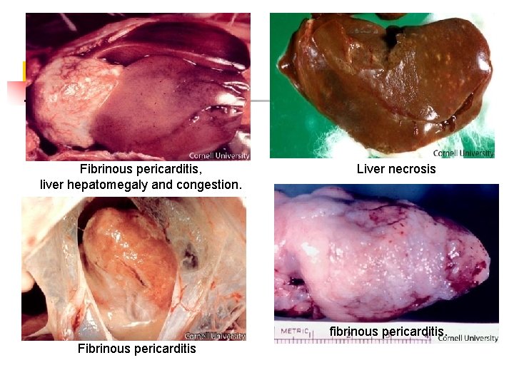 Fibrinous pericarditis, liver hepatomegaly and congestion. Liver necrosis fibrinous pericarditis. Fibrinous pericarditis 