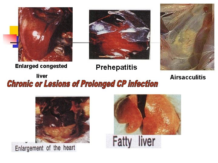 Enlarged congested liver Prehepatitis Airsacculitis 